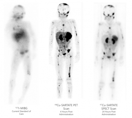 Diagnostic scan comparison